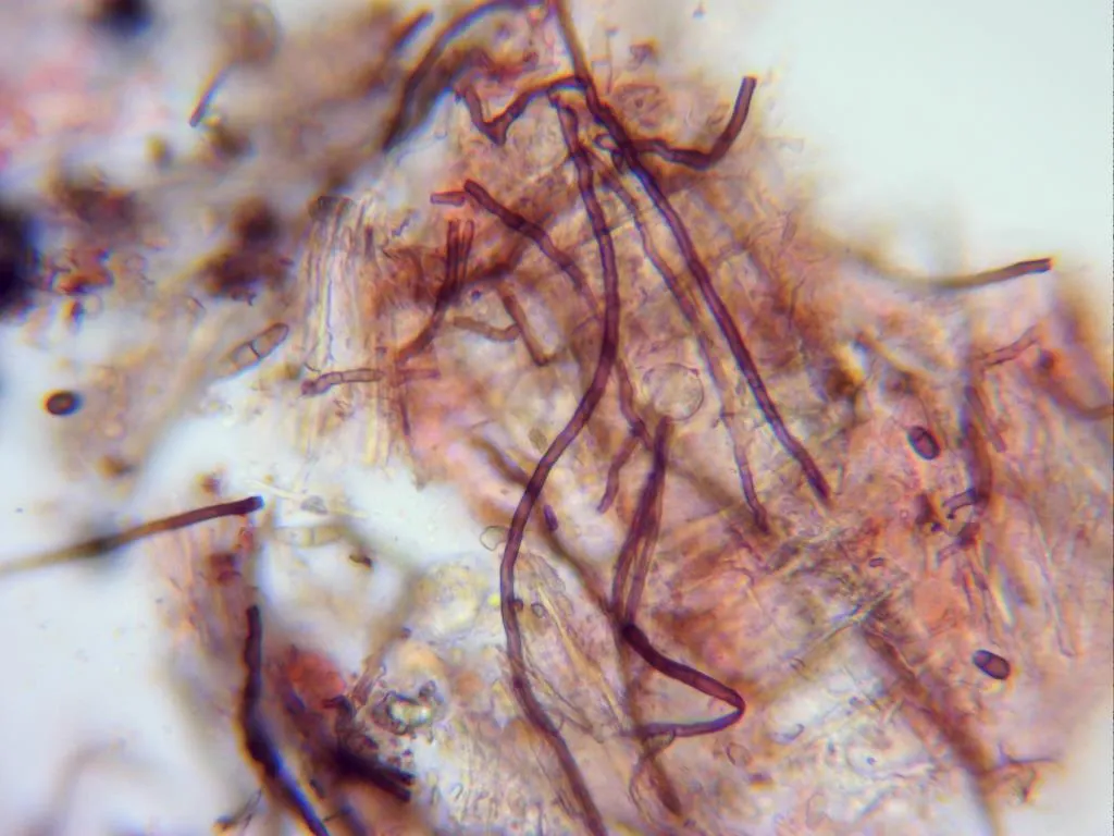 Microscopía de Lophiotrema rubi - 16 - Hifas x 400